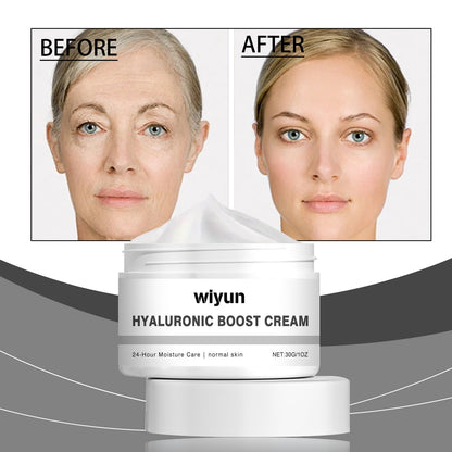 Hyaluronic Acid Moisturizer